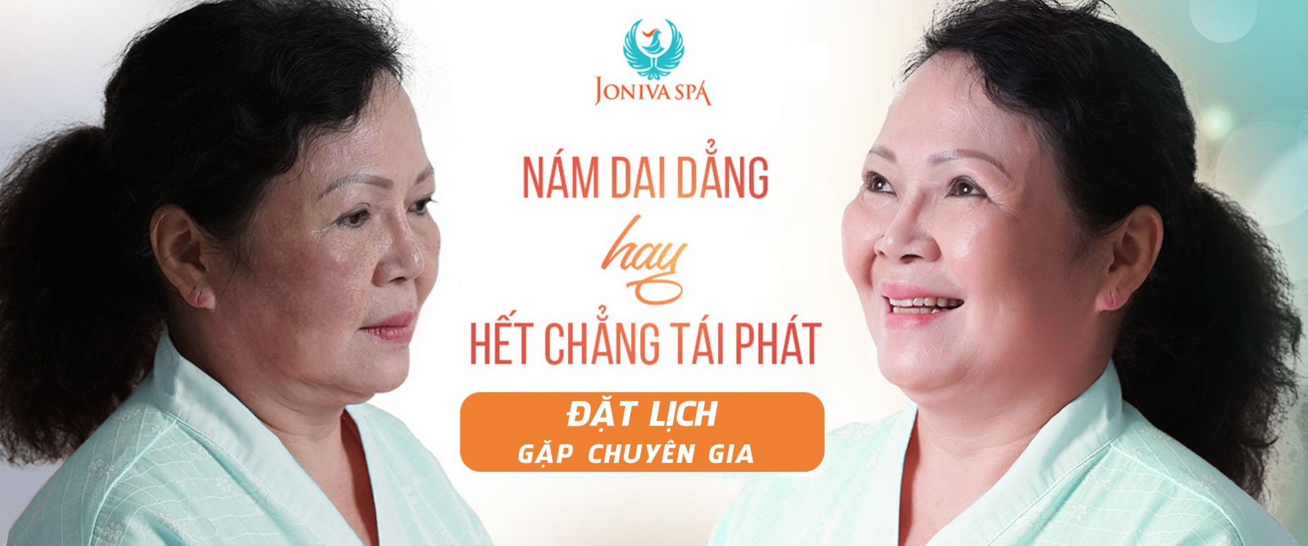 Joniva SPA siêu trị nám không tái phát